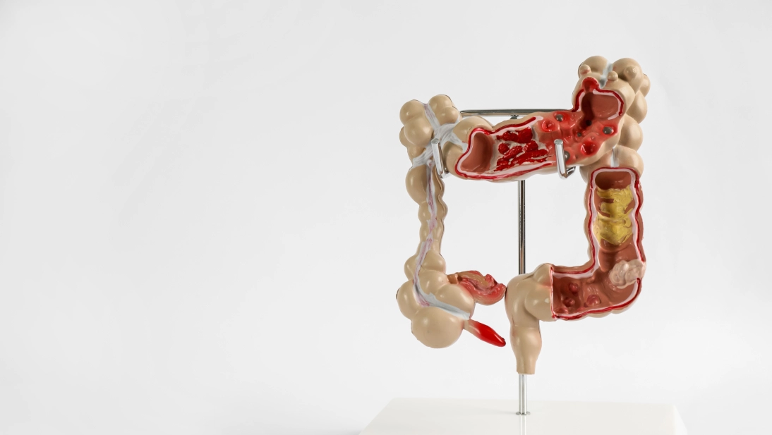 Huzurevinde Ürostomi Hastası Bakımı